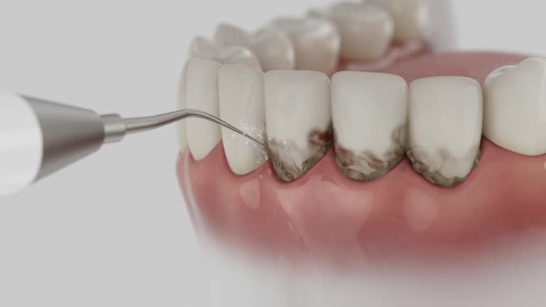 Reliable Teeth Whitening contractor in LaMoure County County, ND by Dentist Open Now
